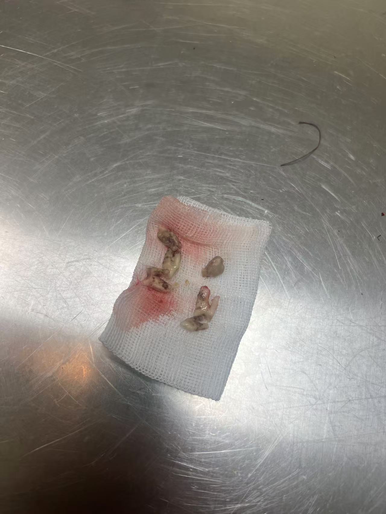 富贵拔除的牙齿